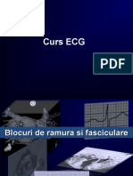 ECG Curs Aritmii