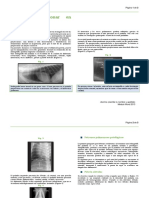 Radiología Pulmonar