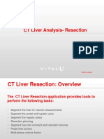Vpmc 14292a Ct Liver Analysis Workflow