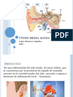 Otitis Media Aguda