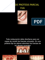 diseodeprotesisparcialfija-100505142359-phpapp01