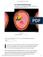 Power Causes Brain Damage - The Atlantic