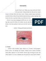 Blepharitis