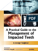 A Practical Guide To The Management of Impacted Teeth PDF