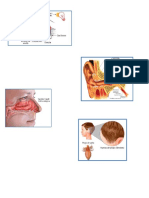 conjuntivitis