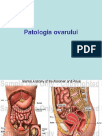 PATOLOGIA OVARULUI