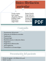 Fibrilación Auricular