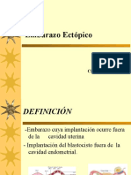 Embarazo Ectópico: Diagnóstico y Tratamiento