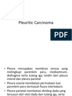 Pleuritic Carcinoma