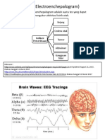 EEG (Electroenchepalogram) : EEG Atau Electroenchepalogram Adalah Suatu Tes Yang Dapat Mengukur Aktivitas Listrik Otak