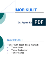 Tumor Kulit 