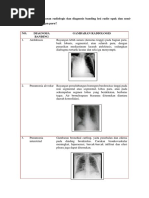 Panduan Radiografi Thorax Normal | PDF