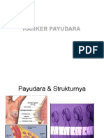 kanker payudara