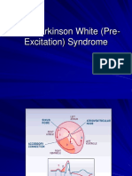 09 Wolff Parkinson White (Pre-Excitation) Syndrome - גליקסון