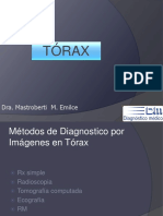 Torax