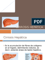 Cirrosis hepatica y complicaciones