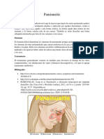 Pan Sinusitis