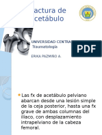 Fractura de Acetábulo