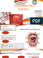 Faringitis Aguda