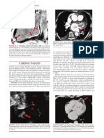 Fundamentals of Diagnostic Radiology Cardiac Masses