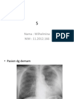 Nama: Wilhelmina NIM: 11.2012.166