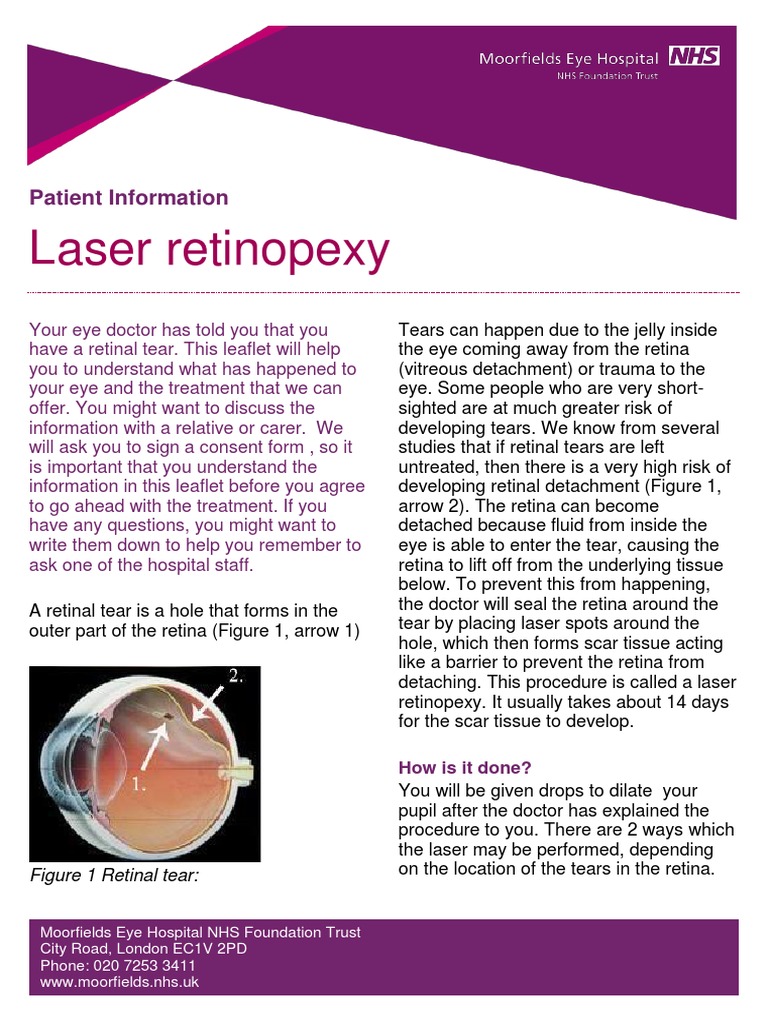 laserretinopexy.pdf Medical Specialties Vision