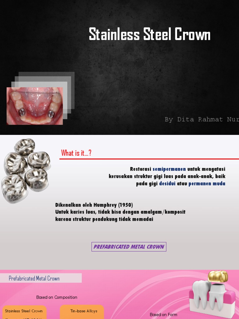 Stainless Steel Crown PDF