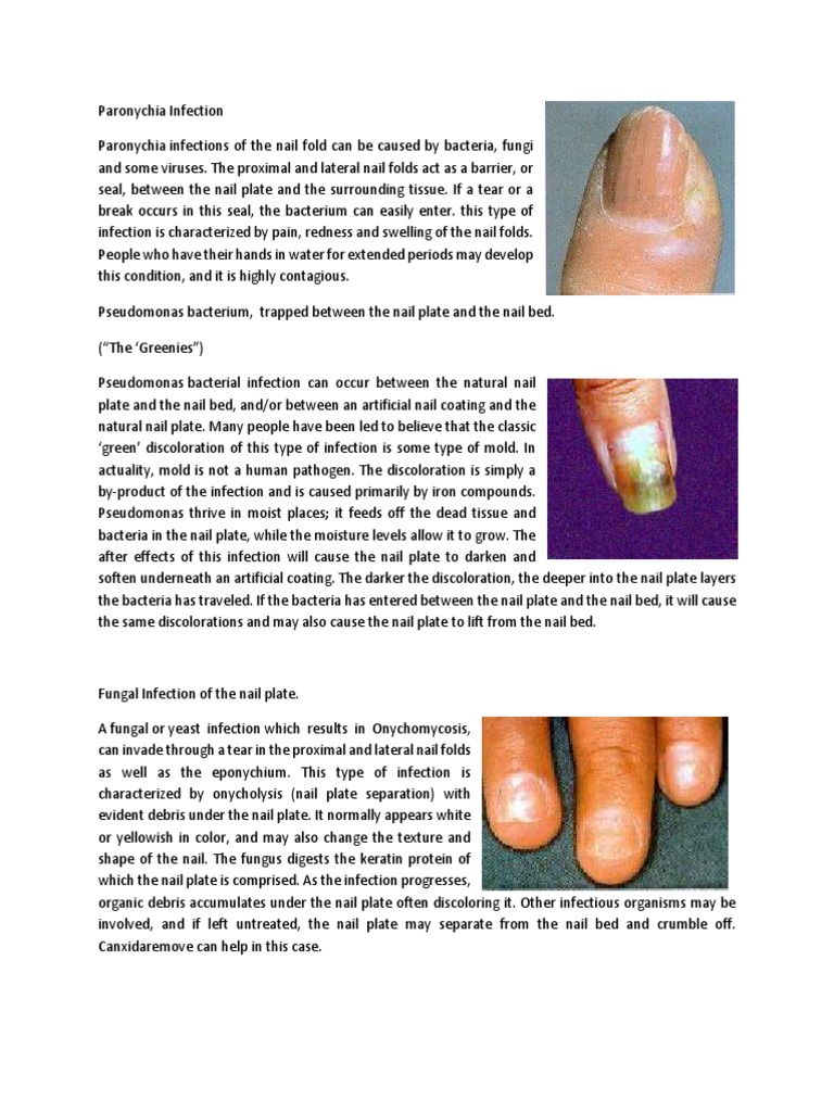 Infections of the hand - Clinical Tree, image size:768x1024