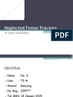Neglected Femur Fracture