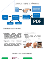 Pancreas Alt Alc