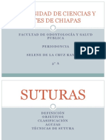 Tipos de Suturas