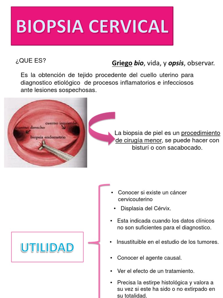 biopsiaCervix.pptx Biopsia Cáncer de cuello uterino