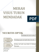 Mata Tenang Visus Turun Mendadak