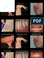 Orofacial Syndrome Quiz