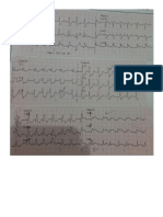 Print Ekg Dan Echo Pasien