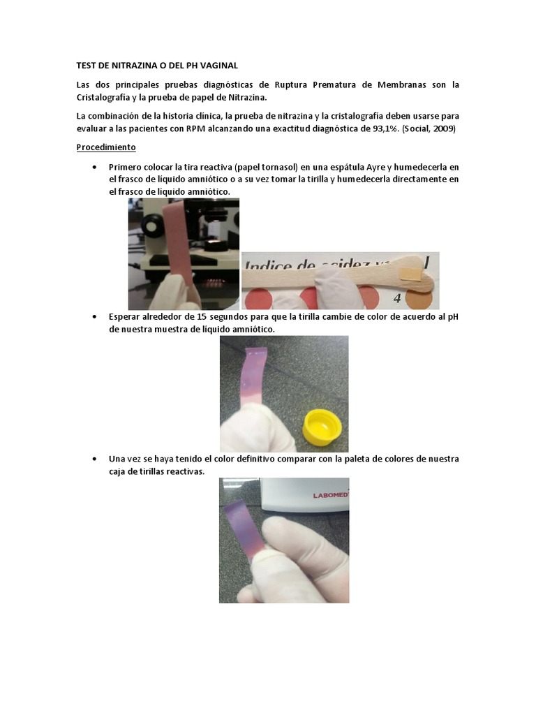 Prueba de Nitrazina y Cristalografía RPM | PDF