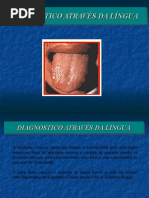 DIAGNÓSTICO+ATRVÉS+DA+LÍNGUA.ppt