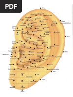 Mapa de Auriculoterapia
