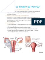 Ligadura de Trompa de Falopio