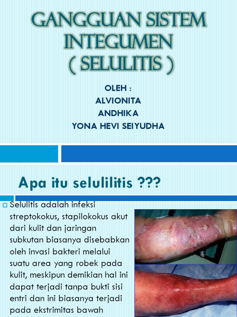 Selulitis | PDF