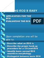 Ecg Made Easy