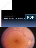 Treatment of Macular Edema