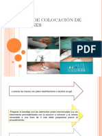 Técnica de Colocación de Soluciones 2