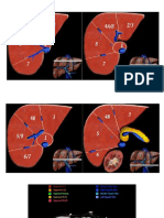 Segmentación Hepática.pdf