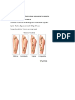 Tipos de Fractura