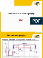 Basic ECG