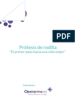 Protesis de Rodilla El Primer Paso para Una Vida Mejor Operarme Es