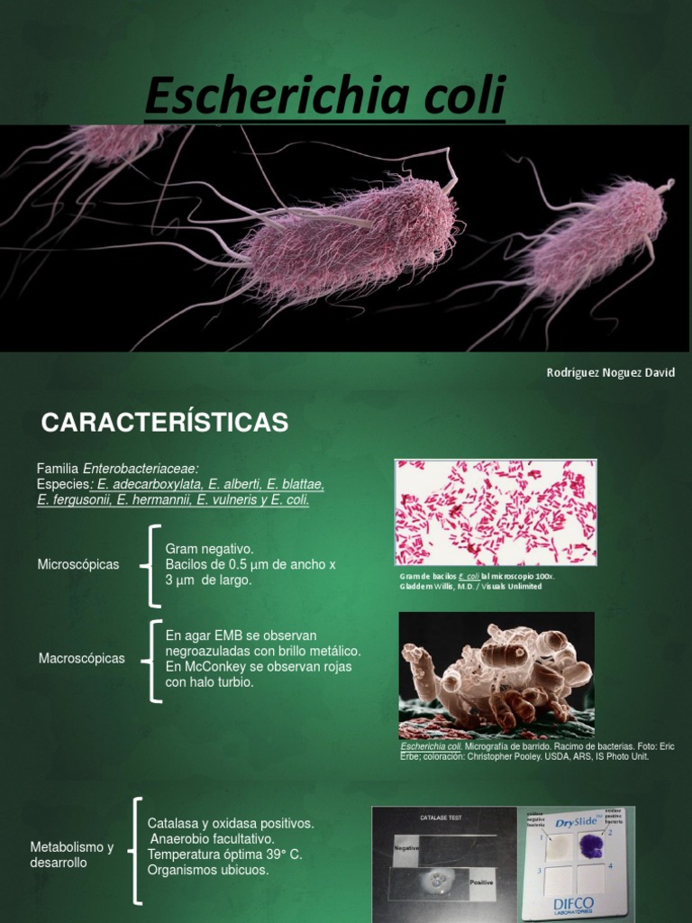E. Coli | PDF | Escherichia coli | Diarrea