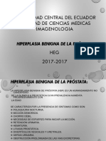 Hiperplasia Prostatica Benigna.