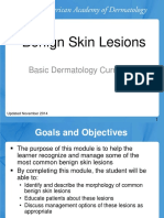 Benign Skin Lesions